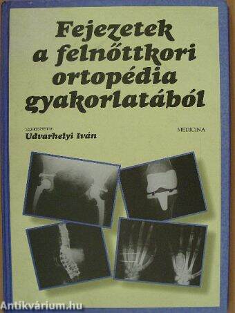 TENS elektroterápia ízületi porckopás kezelésére Az artrózis kezeléséről szóló könyvek