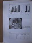 Creatine Kinase Isoenzymes