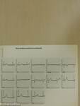 Electrocardiography