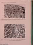 Morphological and Morphometrical Analysis of Circulation in Hypertension and Ischemic Kidney