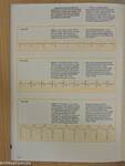 Understanding the Electrocardiogram 3