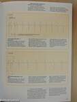 Understanding the Electrocardiogram 3