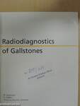 Radiodiagnostics of Gallstones