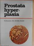 Prostata hyperplasia