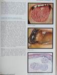 Color Atlas of Oral Pathology