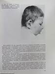Ideggyógyászati és idegsebészeti vizsgálatok csecsemő- és gyermekkorban