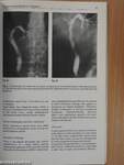 Bile and Bile Duct Abnormalities