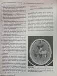 Basic Neurology