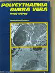 Polycythaemia rubra vera klinikuma, pathologiája és korszerű kezelése