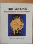 Thrombolysis