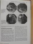 Contrast Media in Urography, Angiography and Computerized Tomography