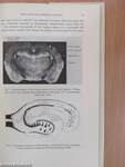 Mechanisms of Drug Toxicity