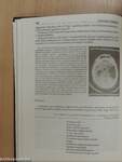 Psychiatria Hungarica 1993/1-6./Az inszomnia kezelése