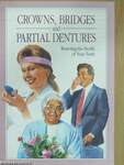 Crowns, Bridges and Partial Dentures