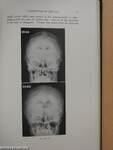 The Normal Encephalogram