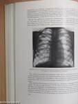 Vorlesungen über die Tuberkulose des Kindes und Jugendlichen