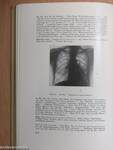 Differentialdiagnose der Lungenröntgenbilder
