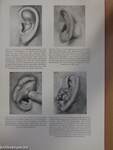 Atlas der Hals-, Nasen-, Ohrenkrankheiten