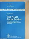 The Acute Facial Palsies 
