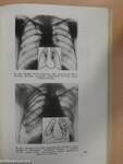 Gyakorlati tüdődiagnosztika