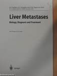 Liver Metastases