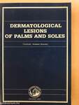 Dermatological Lesions of Palms and Soles