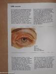 Erkrankungen des Auges 4