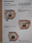 Erkrankungen des Auges 5