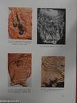 Atlas Der Pathologischen Anatomie