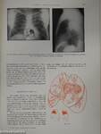 Röntgenanatomische Grundlagen Der Lungenuntersuchung