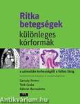 Ritka betegségek, különleges kórformák a szimultán terhességtől a foltos lázig