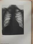Röntgenatlas der Lungenerkrankungen