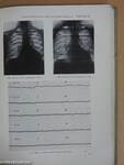 Die Herzkrankheiten im Röntgenbild und Elektrokardiogramm