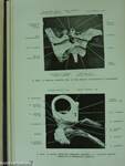 Fül-orr-gégegyógyászat 1957-1958. március-december