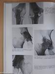 Ízületi betegségek röntgendiagnosztikája