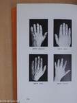 Die Medizinische Hand- und Nagel-Diagnostik