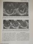 Progress in Cardiology 8