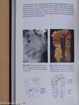 Diseases of the Colon and Rectum