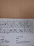 Fundamentals of Electronic Fetal Monitoring