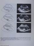 Atlas of Two-Dimensional Echocardiography in Congenital Cardiac Defects