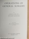 Operations of general surgery