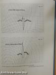 The Minnesota Code Manual of Electrocardiographic Findings