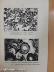 Stratigraphic Gaps of the Carbonate Sequences (Series) of the Ionian Zone of Albania