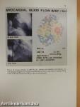 The Pathophysiology of Myocardial Perfusion