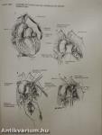 Atlas of Cardiac Surgery