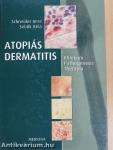 Atopiás dermatitis