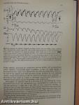 Fetal Heart Rate Monitoring