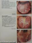 Orofacialis betegségek atlasza