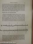 Diagnosis and Treatment of Cardiac Arrhythmias Following Open Heart Surgery