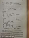 Sudden Death due to Acute Myocardial Infarction